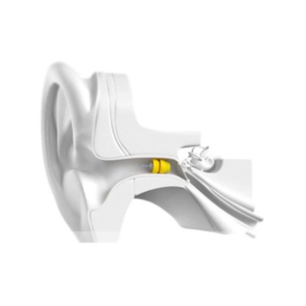 Lyric – Extended wear, can be worn 24/7, 100% Invisible – known as the contact Lens for your ear.