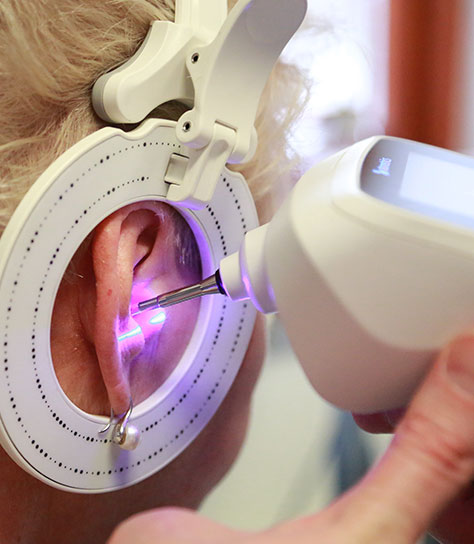 The Otometrics Otoscan - advanced hearing test in sutton coldfield