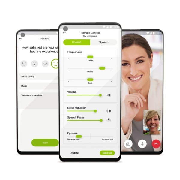 Phonak Virto Paradise - Image 4