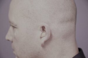ITE – In the Ear