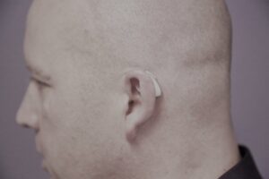 RITE – Receiver in the Ear